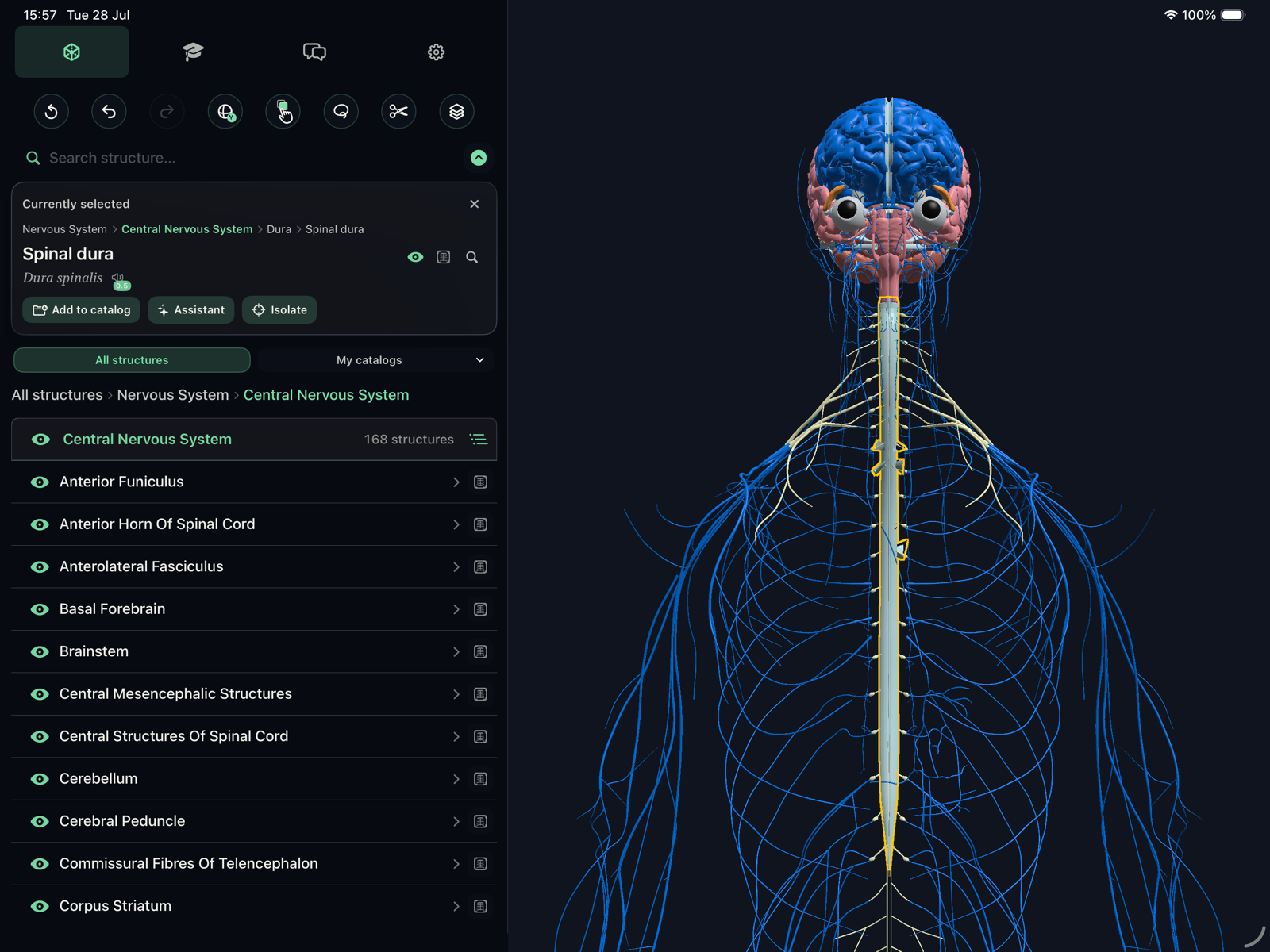 iPad nervous system catalog with spinal dura highlighted in 3D